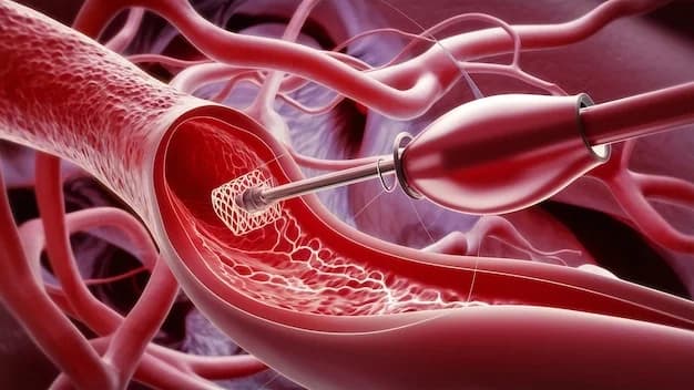 Mechanical Thrombectomy