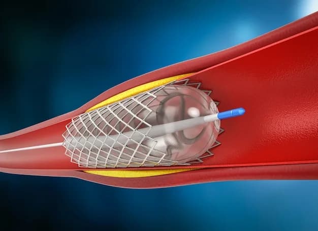 Intracranial Angioplasty and Stenting